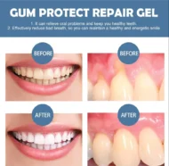 📢📢49% Off!!⏰ Teeth Whitening & Repair Gel 🦷 - Image 2