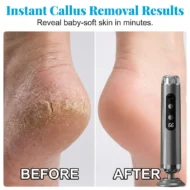 🥳2026 HOT SALE🥳💞50K+ SOLD!🏖️👍 50% OFF! 27,000 RPM Electric Foot Renewal – 5 speeds, disposable pads. No scrubbing, salon smooth at home. 🦶✨ - Image 2