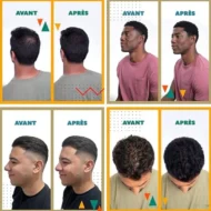 🎁Hot Sale 49% OFF🔥Hair Building Fibers Set for Thinning Hair & Bald Spots - Image 4