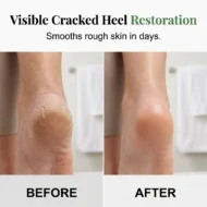 Natural Tea Tree Oil Foot Care - Image 2