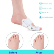 Bunion Corrector for Men and Women - Image 6