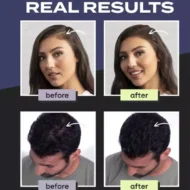 🎁Hot Sale 49% OFF🔥Hair Building Fibers Set for Thinning Hair & Bald Spots - Image 6