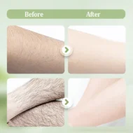 Gentle and Non-Irritating Hair Removal Cream - Image 6