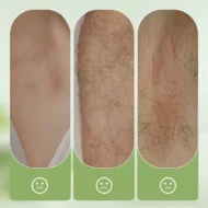 Gentle and Non-Irritating Hair Removal Cream - Image 5